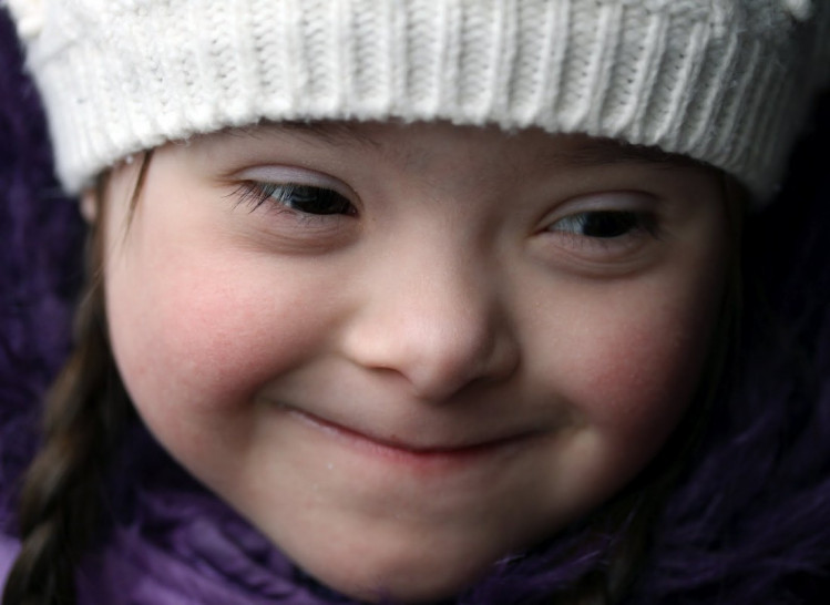 imagen Día Internacional del Síndrome de Down: por qué es vital la inclusión